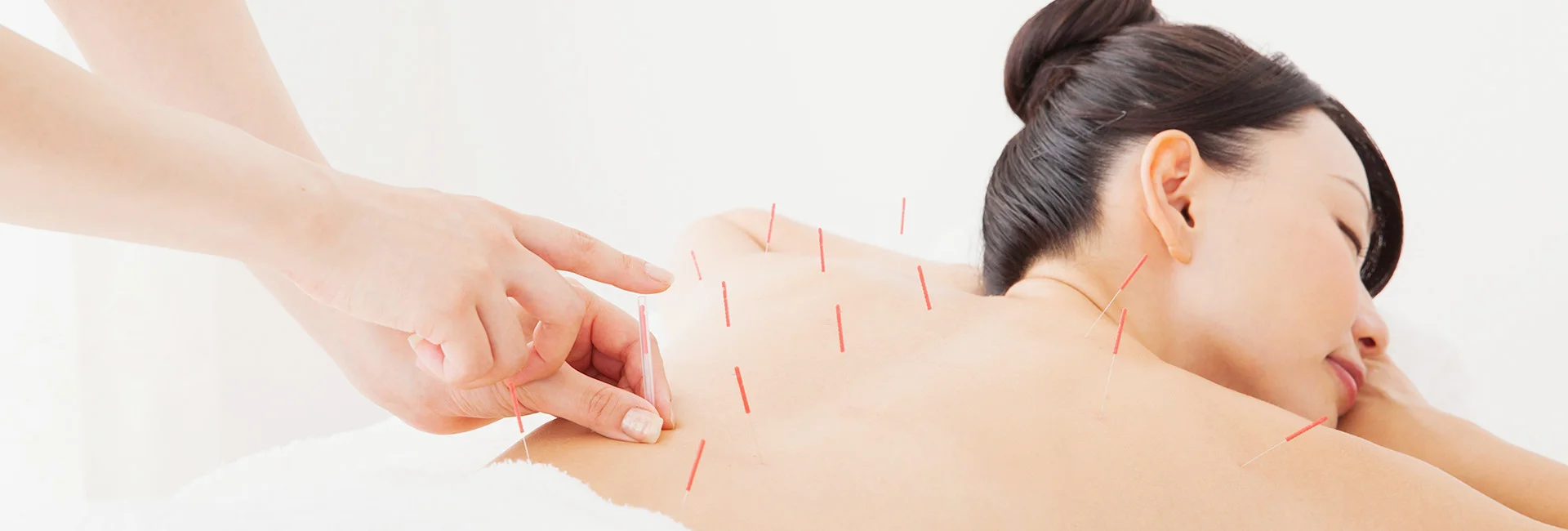 白いシーツを整えた施術ベッドと、手元に置かれた鍼灸道具